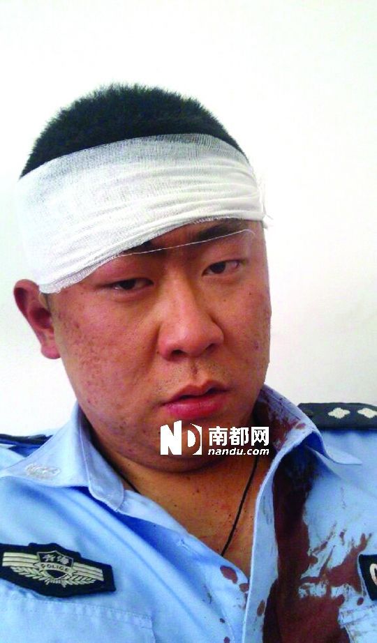 警察遭20余名城管围殴，城管为什么围殴警察|视频
