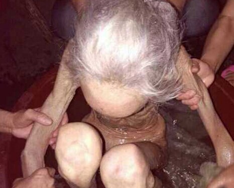 九十岁老人遭虐待 湖南90岁老人遭儿孙虐待骨瘦如柴照片图