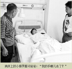 女孩被继母剁手 福建发生继母虐待女童事件继母砍断女孩右手