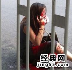 央视女员工遭割鼻图