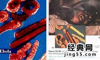 埃博拉病毒感染死亡照片（图）