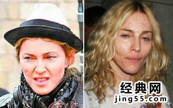 麦当娜整容前的照片 麦当娜整容前后对比照